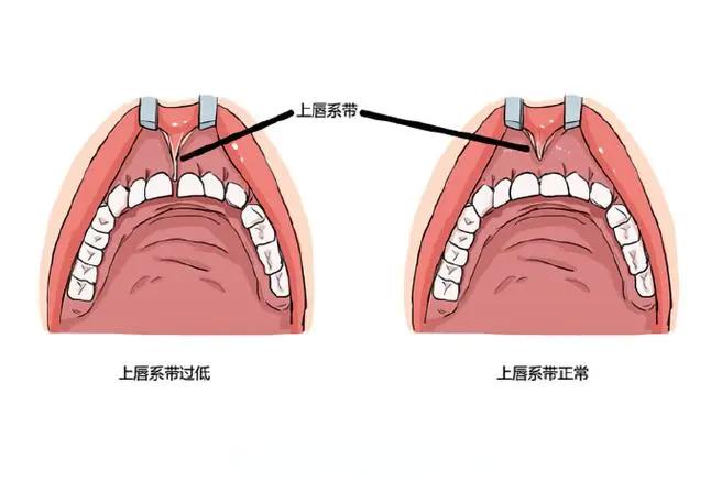 牙齒矯正九